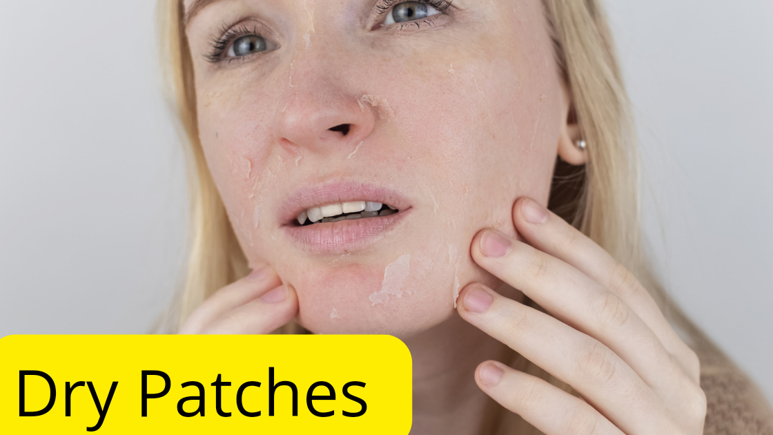 Having dry patches on the skin